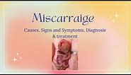 MISCARRIAGE, Causes, Signs and Symptoms, Diagnosis and Treatment.