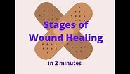 Stages of Wound Healing in 2 mins!