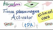 Clinical Uses of Tissue Plasminogen Activator (tPA)