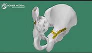 Double Medical Complete Pelvic Fracture Treatment Solutions