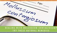 Dealing With Molluscum Contagiosum? Try These Natural Remedies -