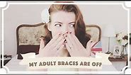 Adult Braces: Taking Braces Off (9 Month Update) [CC]
