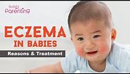 Baby Eczema - Causes, Signs and Treatment