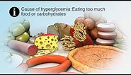 Treating High Blood Sugar | Hyperglycemia | Nucleus Health