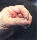 All about acupuncture - Horse & Hound