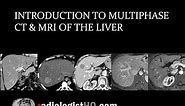Introduction to Multiphase CT & MRI of the Liver