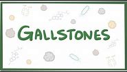 Gallstones (cholelithiasis)