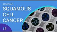 Squamous Cell Cancer [Dermatology]