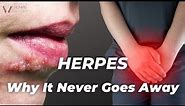 Herpes - The Gift That Keeps On Giving