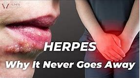 Herpes - The Gift That Keeps On Giving
