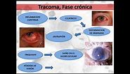 2017/06 -Chlamydia trachomatis: diagnóstico por Biología Molecular
