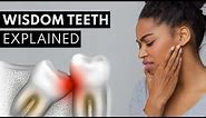 Wisdom Teeth Explained (Pain, Symptoms, & Extractions)