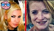 Top 10 Shocking Before And After Drug Use Photos
