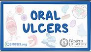 Western University - Oral Ulcers