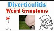 Weird Symptoms of Diverticulitis | Atypical Clinical Features of Diverticulitis