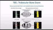 How to use TBS (Trabecular Bone Score) in combination with BMD in Clinical DXA practice.