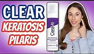 HOW TO CLEAR KERATOSIS PILARIS ON THE FACE| DERMATOLOGIST @DrDrayzday