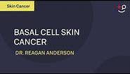 What is Basal Cell Skin Cancer? - Basal Cell Cancer Explained [2019] [Dermatology]