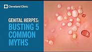 Busting 5 Myths About Genital Herpes