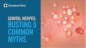 Busting 5 Myths About Genital Herpes