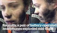 iPhone explodes in owner's hands