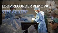 Getting your loop recorder removed? Watch a live procedure!