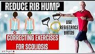 How To Fix Rib Hump | SCOLIOSIS