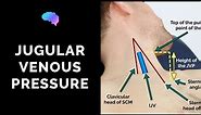 Measuring Jugular Venous Pressure (JVP) - OSCE Guide (Clip) | UKMLA | CPSA