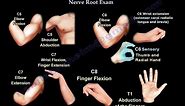 Cervical Spine Nerve Root Exam - Everything You Need To Know - Dr. Nabil Ebraheim