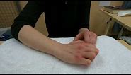 Hand injury exercise 6: Active big knuckle straightening