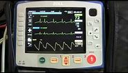 Instruction of the Zoll X Series - Part 3 (Basic EKG Monitoring)