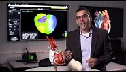 Developing a digital twin of the heart
