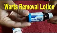 Wart Removal Lotion