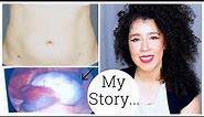 I'm Back! | My Ovarian Cyst Story | Ovarian Torsion | Laparoscopy Surgery