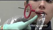 Premolar bitewing positioning tips for dental x-rays