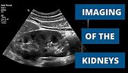 How to Image the Kidneys - When to Use Ultrasound, CT, and MRI