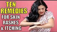 How to Get Rid of Skin Rashes and Itching Naturally
