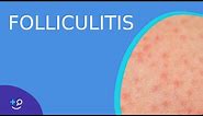 Folliculitis - Daily Do's of Dermatology