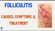 FOLLICULITIS Causes, Symptoms, & Treatments