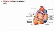 External Features of the Heart - Dr. Ahmed Farid