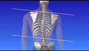 Scoliosis - Curvature of the Spine