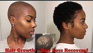 4 Month Update! | Hair Regrowth After HAIR LOSS + Current Hair Care Routine | #GrowWithMe | Nia Hope