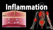 Inflammatory Response, Animation