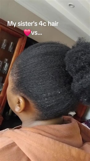 Understanding Your Hair Type: A Guide for 4C Hair