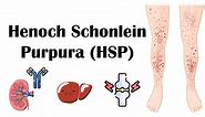 Henoch Schonlein Purpura (HSP) - Causes, Signs & Symptoms, Complications, Diagnosis & Treatment