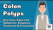 Colon Polyps - Overview, Signs and Symptoms, Diagnosis, Treatment and Prevention