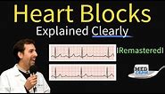 Heart Blocks Explained - First, Second, Third Degree and Bundle Branch on ECG