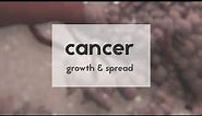 Cancer: growth & spread