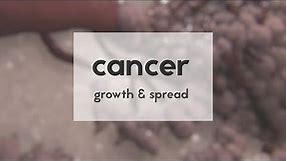 Cancer: growth & spread