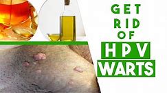 How to Get Rid of HPV Genital Warts at Home Fast - 3 Tips You MUST Know